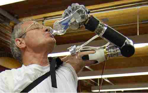 智能假肢 智能假肢